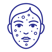 Spots or pimples that may be red or inflamed